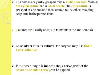  The nerves are gently grasped with a Bishop forceps. With an
8-0 nylon suture and a GS-8 needle, the epineurium is
grasped at one end and then sutured to the other, avoiding
deep cuts in the perineurium
 3 sutures are usually adequate to maintain the anastomosis
 As an alternative to sutures, the surgeon may use fibrin
tissue adhesive.
 If the nerve length is inadequate, a nerve graft of the
greater auricular nerve, can be applied
 