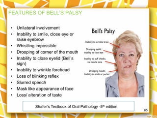 Facial nerve PRESENTATION | PPTX
