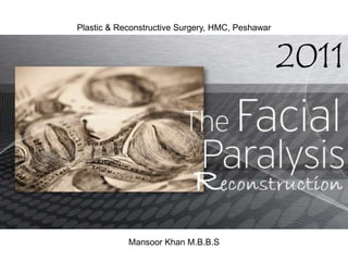 Plastic & Reconstructive Surgery, HMC, Peshawar 2011 Mansoor Khan M.B.B.S 