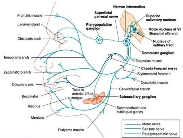 Facial Nerve Tract 87