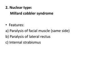 2. Nuclear type:
Millard cobbler syndrome
• Features:
a) Paralysis of facial muscle (same side)
b) Paralysis of lateral rectus
c) Internal strabismus
 