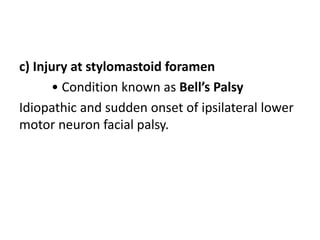 c) Injury at stylomastoid foramen
• Condition known as Bell’s Palsy
Idiopathic and sudden onset of ipsilateral lower
motor neuron facial palsy.
 