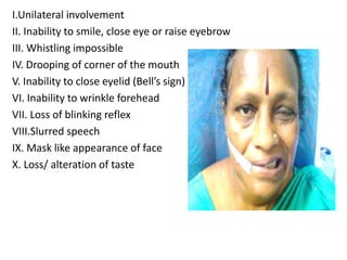 I.Unilateral involvement
II. Inability to smile, close eye or raise eyebrow
III. Whistling impossible
IV. Drooping of corner of the mouth
V. Inability to close eyelid (Bell’s sign)
VI. Inability to wrinkle forehead
VII. Loss of blinking reflex
VIII.Slurred speech
IX. Mask like appearance of face
X. Loss/ alteration of taste
 