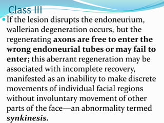 Class III
If the lesion disrupts the endoneurium,
wallerian degeneration occurs, but the
regenerating axons are free to enter the
wrong endoneurial tubes or may fail to
enter; this aberrant regeneration may be
associated with incomplete recovery,
manifested as an inability to make discrete
movements of individual facial regions
without involuntary movement of other
parts of the face—an abnormality termed
synkinesis.
 