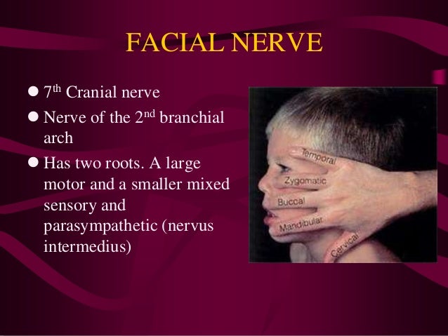 Facial palsy