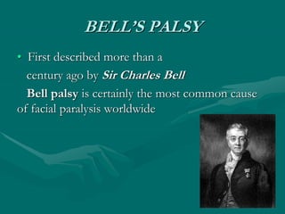 BELL’S PALSY
• First described more than a
century ago by Sir Charles Bell
Bell palsy is certainly the most common cause
of facial paralysis worldwide
 
