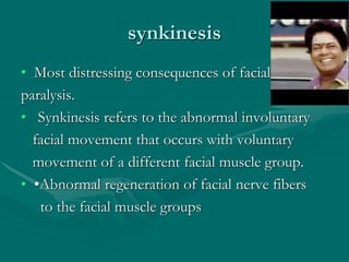 synkinesis
• Most distressing consequences of facial
paralysis.
• Synkinesis refers to the abnormal involuntary
facial movement that occurs with voluntary
movement of a different facial muscle group.
• •Abnormal regeneration of facial nerve fibers
to the facial muscle groups
 