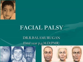 FACIAL PALSY
DR.R.BALAMURUGAN
Final year p.g,M.D(PMR)
 