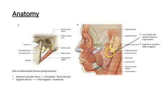 Posttragal Facial Palsy - Surgical Management and Reconstruction | PPTX