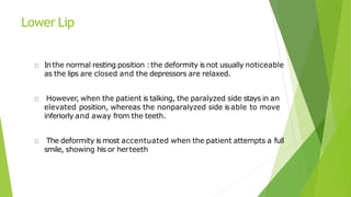 Lower Lip
In the normal resting position :the deformity is not usually noticeable
as the lips are closed and the depressors are relaxed.
However, when the patient is talking, the paralyzed side stays in an
elevated position, whereas the nonparalyzed side isable to move
inferiorly and away from the teeth.
The deformity is most accentuated when the patient attempts a full
smile, showing his or herteeth
 