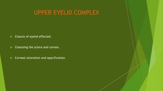 UPPER EYELID COMPLEX
 Closure of eyelid effected.
 Cleansing the sclera and cornea.
 Corneal ulceration and opacification.
 