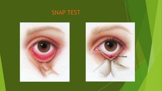 SNAP TEST
 