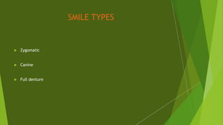 SMILE TYPES
 Zygomatic
 Canine
 Full denture
 