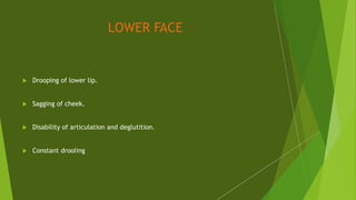 LOWER FACE
 Drooping of lower lip.
 Sagging of cheek.
 Disability of articulation and deglutition.
 Constant drooling
 