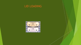LID LOADING
 