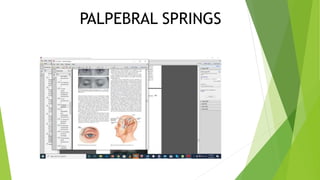 PALPEBRAL SPRINGS
 