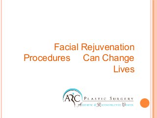 Facial Rejuvenation
Procedures Can Change
Lives
 