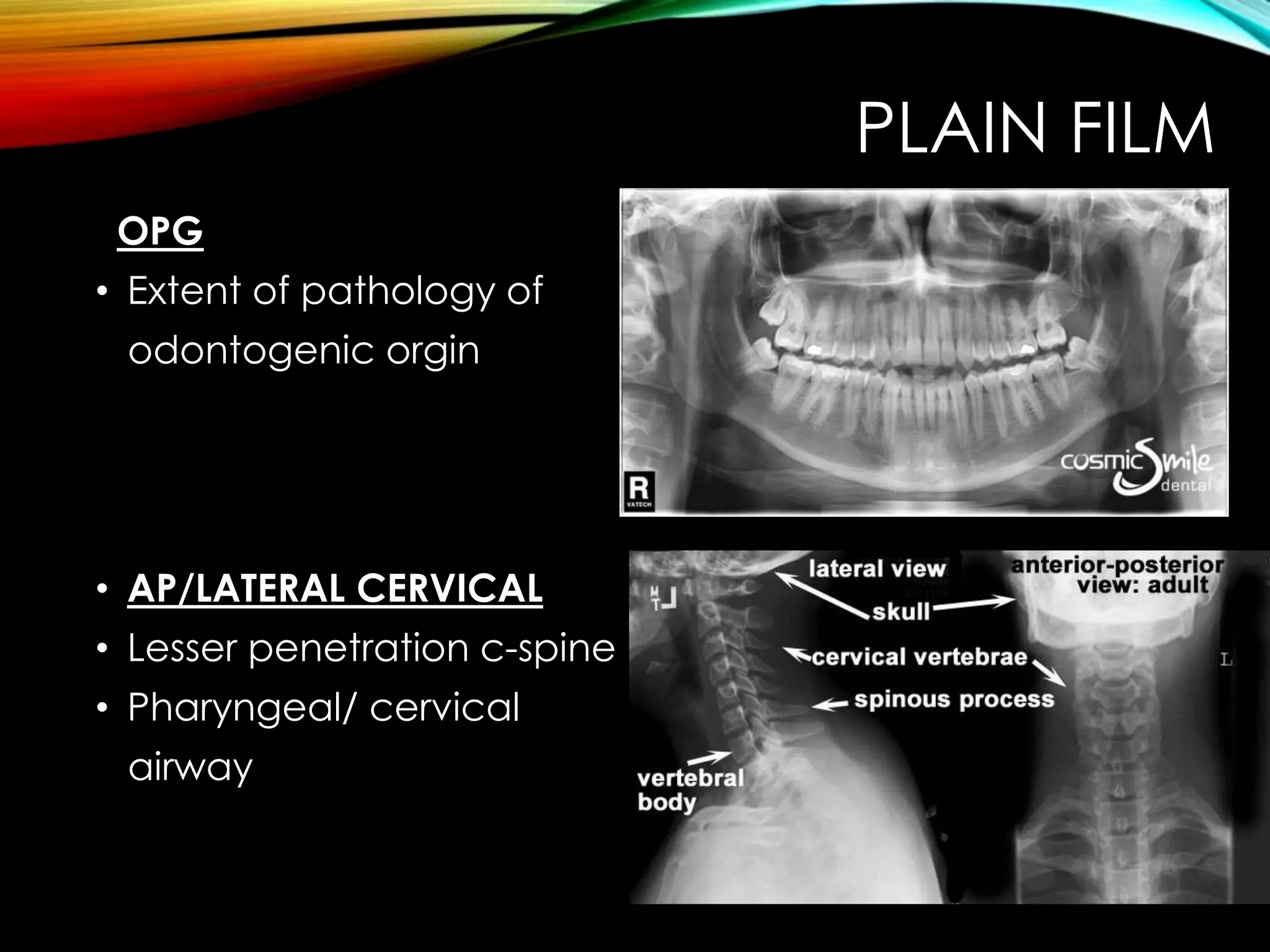 PLAIN FILM 
OPG 
• Extent of pathology of 
odontogenic orgin 
• AP/LATERAL CERVICAL 
• Lesser penetration c-spine 
• Pharyngeal/ cervical 
airway 
 