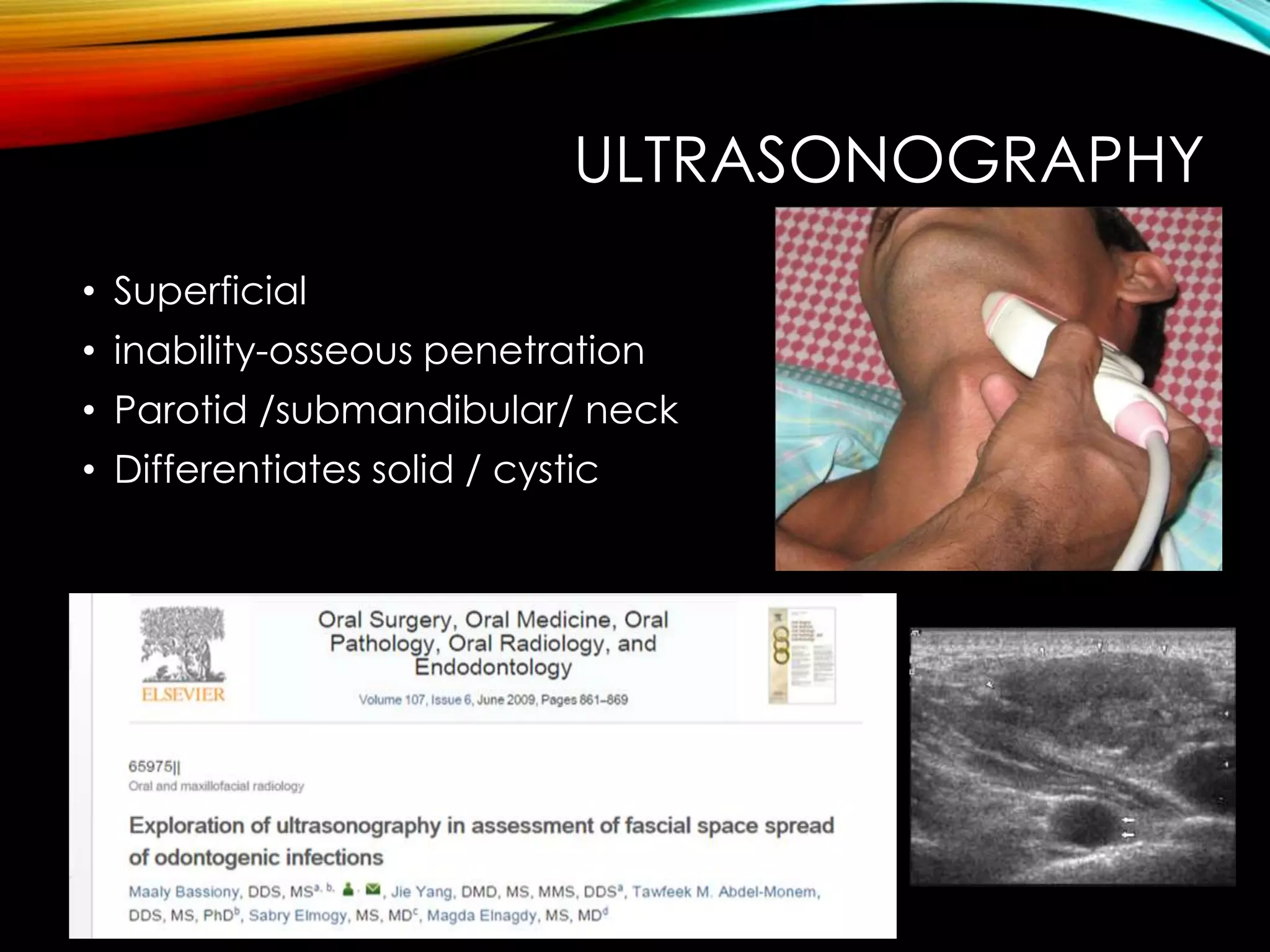 ULTRASONOGRAPHY 
• Superficial 
• inability-osseous penetration 
• Parotid /submandibular/ neck 
• Differentiates solid / cystic 
 