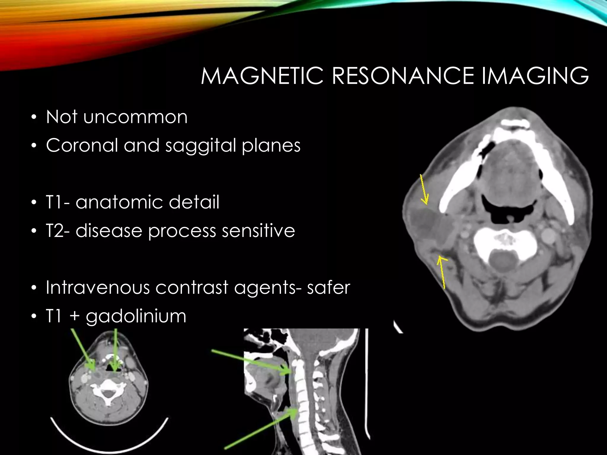 MAGNETIC RESONANCE IMAGING 
• Not uncommon 
• Coronal and saggital planes 
• T1- anatomic detail 
• T2- disease process sensitive 
• Intravenous contrast agents- safer 
• T1 + gadolinium 
 