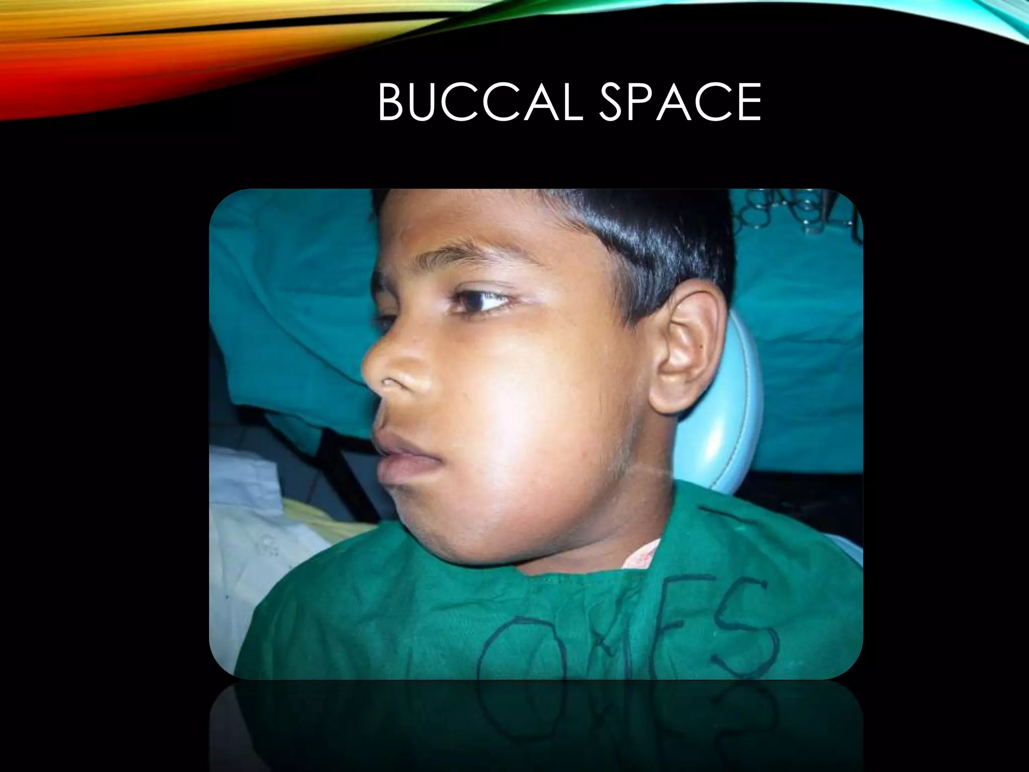 BUCCAL SPACE 
 