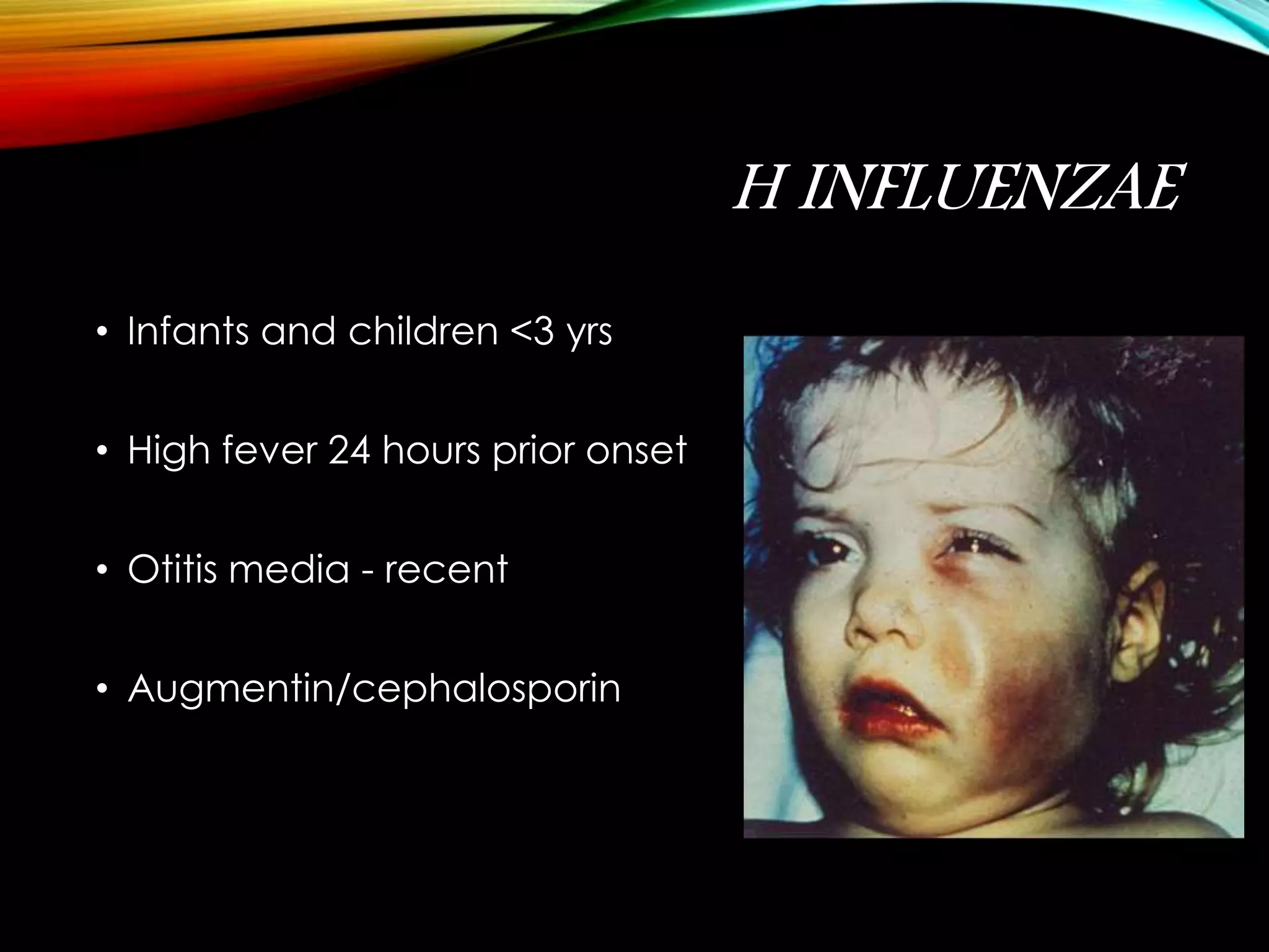 H INFLUENZAE 
• Infants and children <3 yrs 
• High fever 24 hours prior onset 
• Otitis media - recent 
• Augmentin/cephalosporin 
 