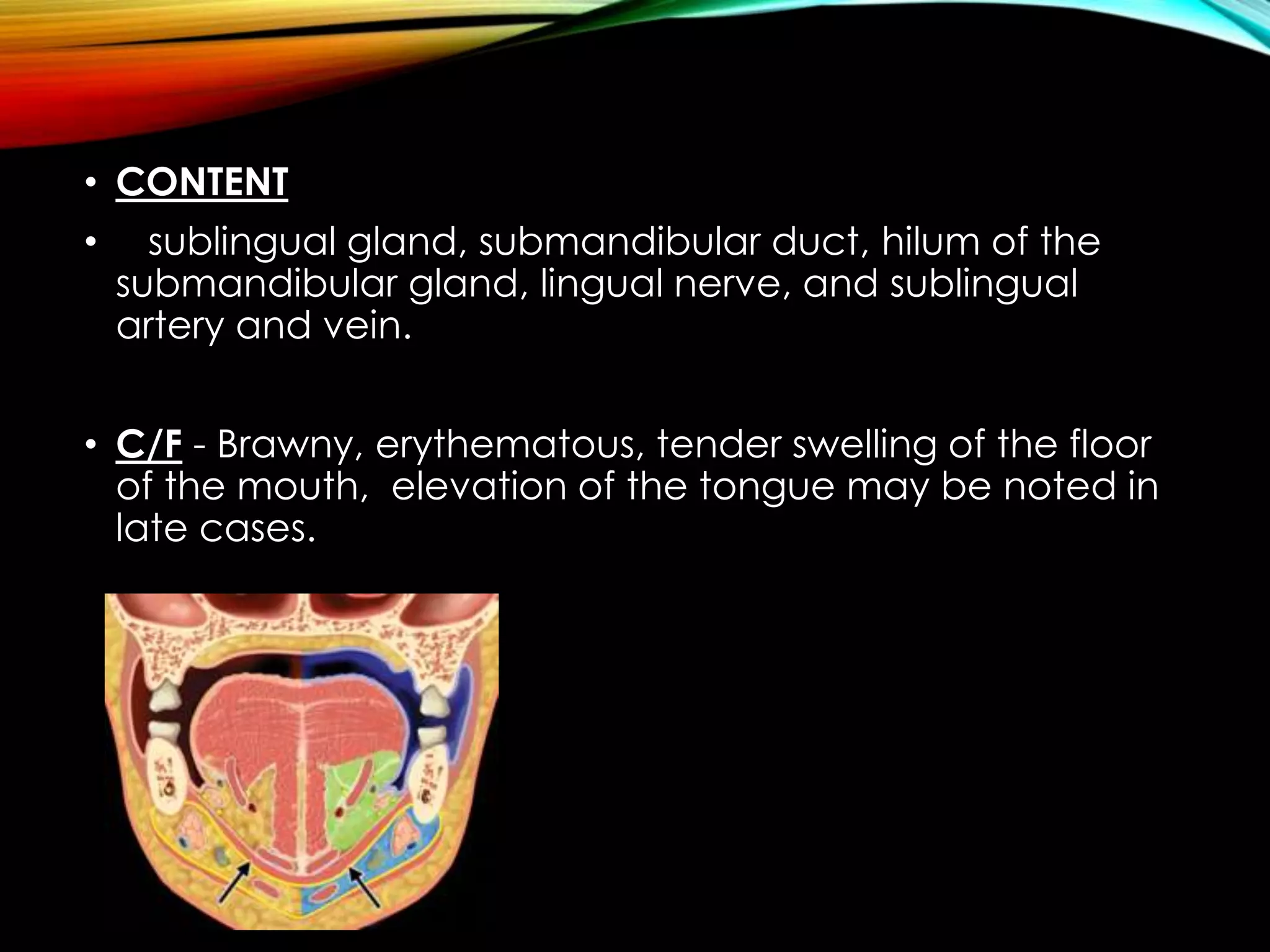 • CONTENT 
• sublingual gland, submandibular duct, hilum of the 
submandibular gland, lingual nerve, and sublingual 
artery and vein. 
• C/F - Brawny, erythematous, tender swelling of the floor 
of the mouth, elevation of the tongue may be noted in 
late cases. 
 