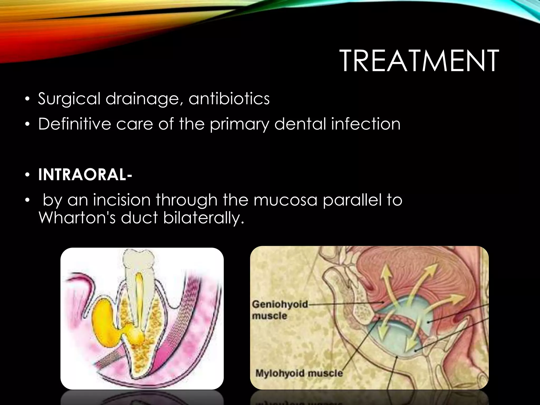 TREATMENT 
• Surgical drainage, antibiotics 
• Definitive care of the primary dental infection 
• INTRAORAL- 
• by an incision through the mucosa parallel to 
Wharton's duct bilaterally. 
 