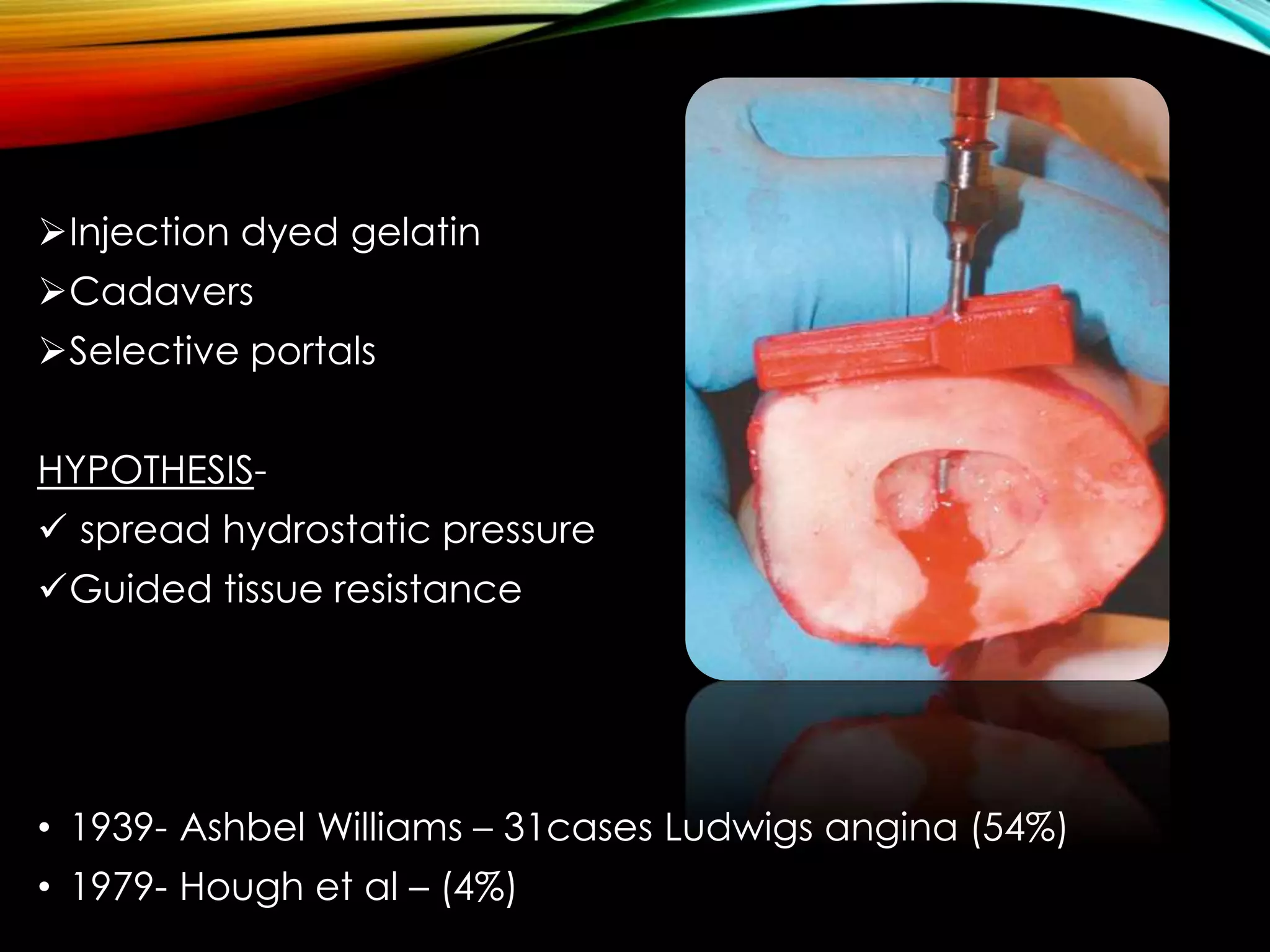 Injection dyed gelatin 
Cadavers 
Selective portals 
HYPOTHESIS- 
 spread hydrostatic pressure 
Guided tissue resistance 
• 1939- Ashbel Williams – 31cases Ludwigs angina (54%) 
• 1979- Hough et al – (4%) 
 