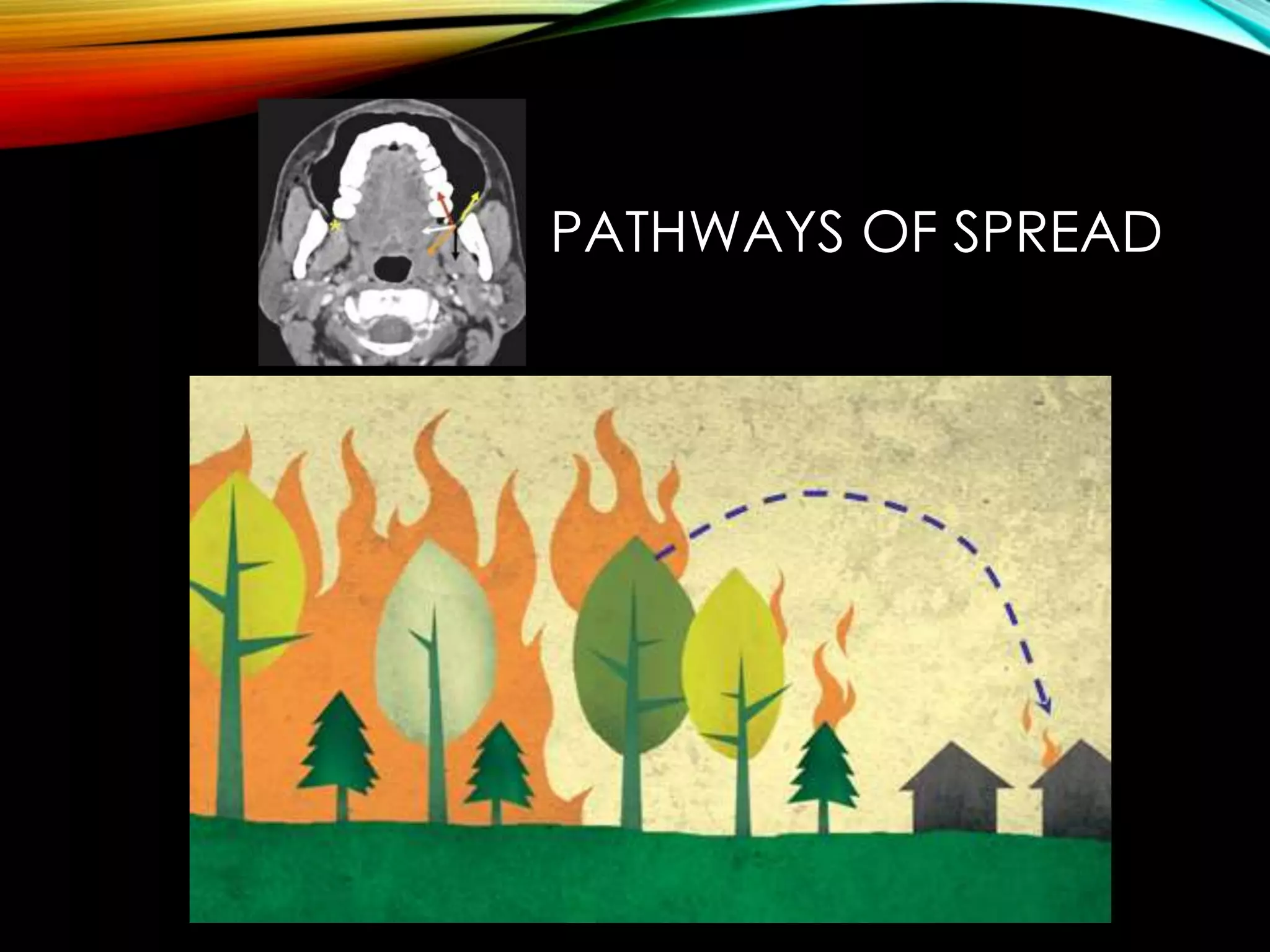 PATHWAYS OF SPREAD 
 