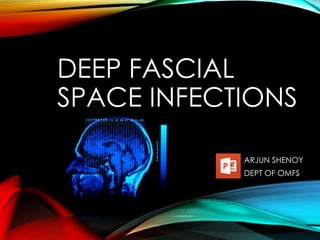 DEEP FASCIAL 
SPACE INFECTIONS 
ARJUN SHENOY 
DEPT OF OMFS 
 