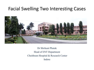 Facial Swelling Two Interesting Cases
Dr Shrikant Phatak
Head of ENT Department
Choithram Hospital & Research Center
Indore
 