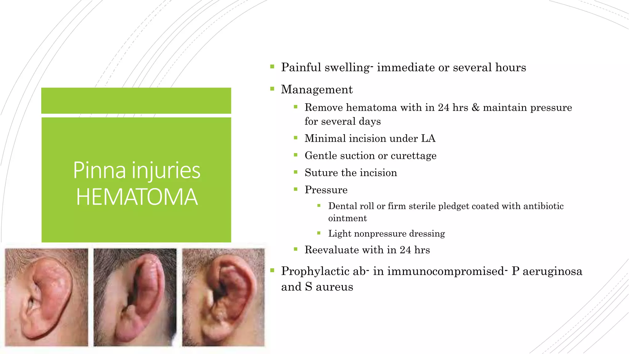 Facial trauma | PPTX