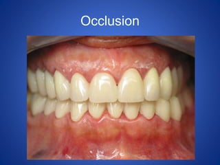 Occlusion
 