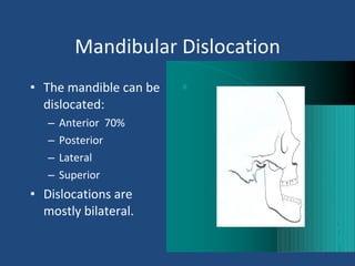 Mandibular Dislocation The mandible can be dislocated: Anterior  70% Posterior Lateral Superior  Dislocations are mostly bilateral. 