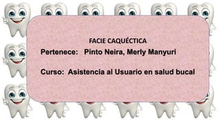 FACIE CAQUÉCTICA
Pertenece: Pinto Neira, Merly Manyuri
Curso: Asistencia al Usuario en salud bucal
 