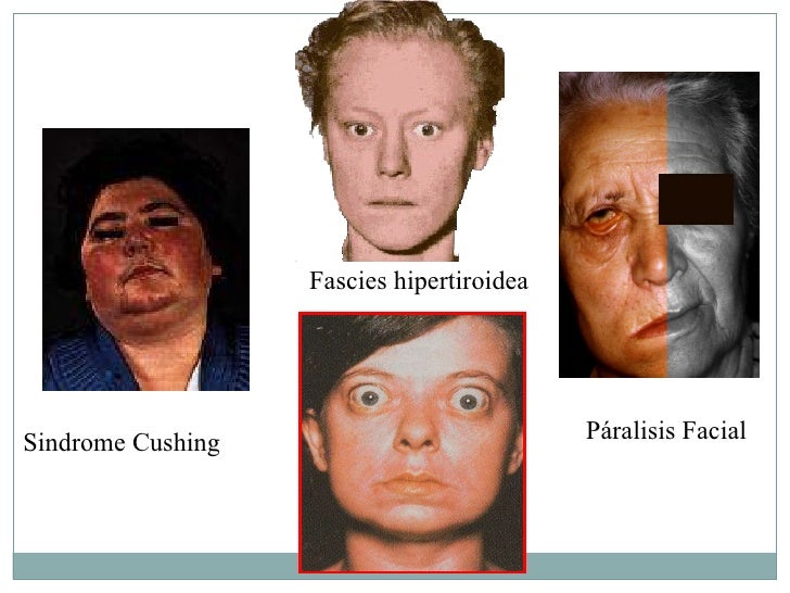 Facies Postura Y Marcha