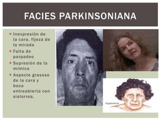 Facies | PPTX