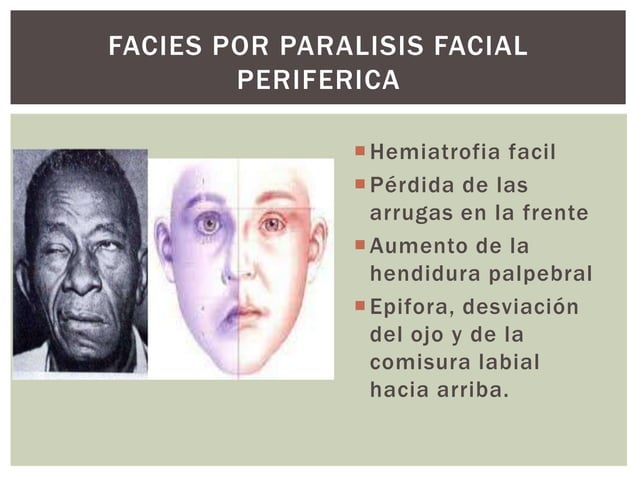 Facies