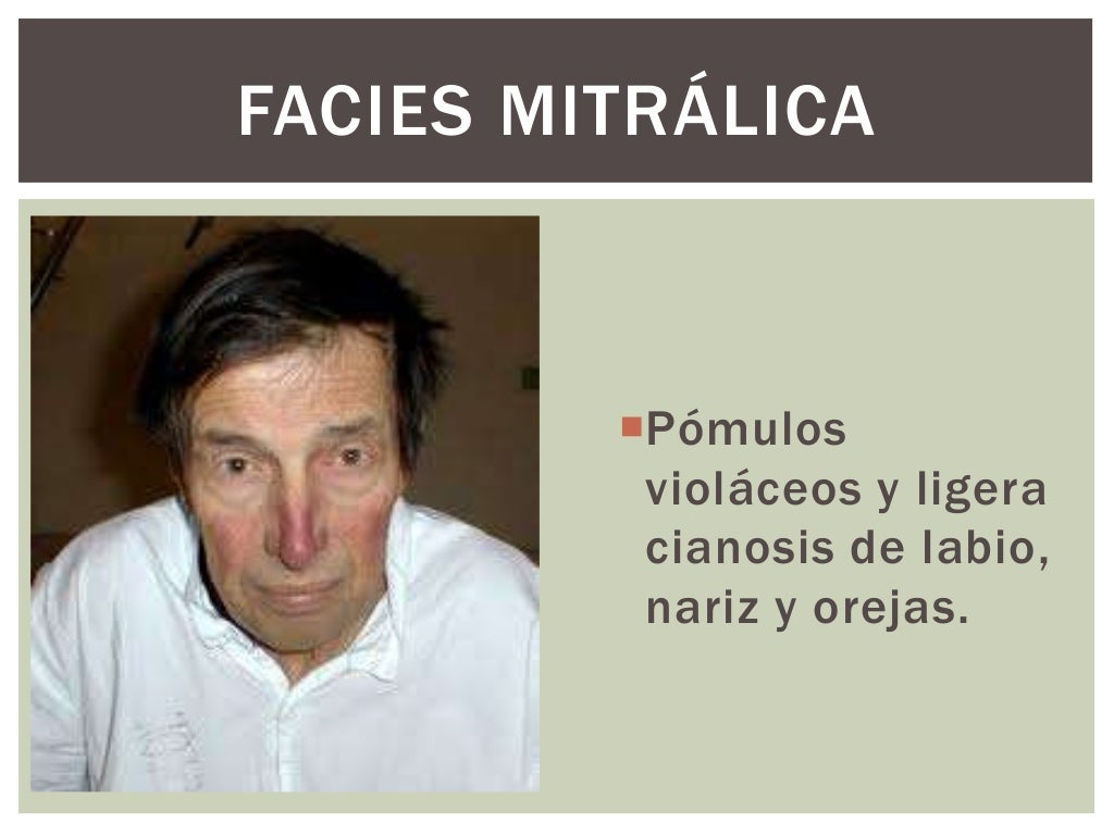 Facies