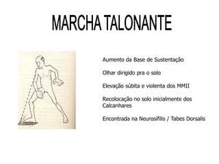 Aumento da Base de Sustentação
Olhar dirigido pra o solo
Elevação súbita e violenta dos MMII
Recolocação no solo inicialmente dos
Calcanhares
Encontrada na Neurosífilis / Tabes Dorsalis
 