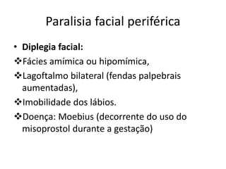 Paralisia facial periférica
• Diplegia facial:
Fácies amímica ou hipomímica,
Lagoftalmo bilateral (fendas palpebrais
aumentadas),
Imobilidade dos lábios.
Doença: Moebius (decorrente do uso do
misoprostol durante a gestação)
 