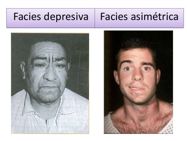 Facies (2)