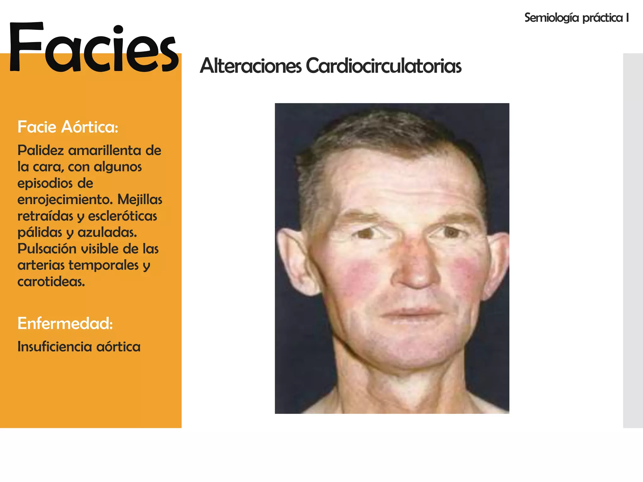 Facies Anormales | PDF