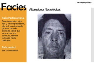 Facies Anormales | PDF