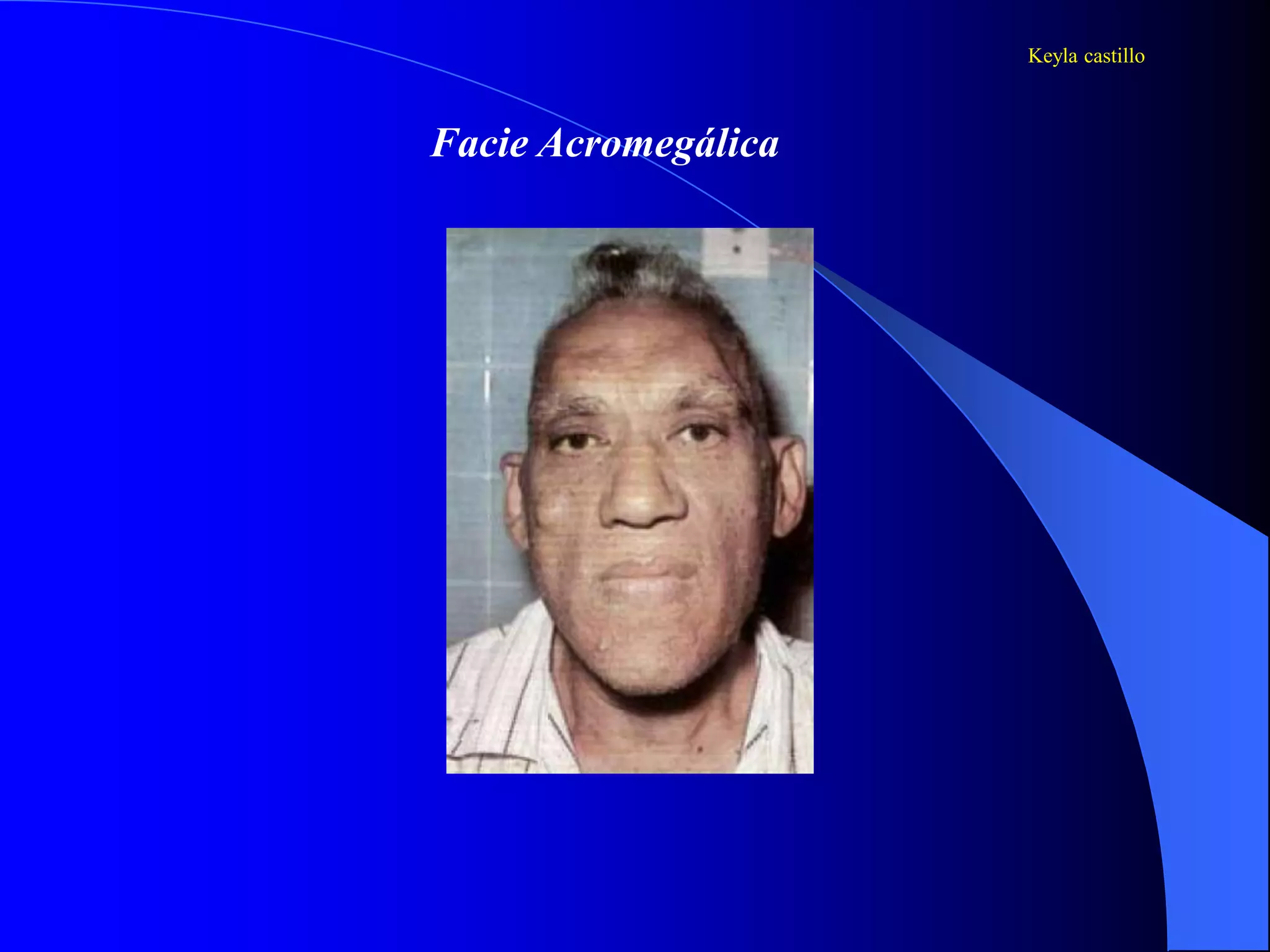 Facies semiologia | PPT