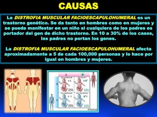 CAUSAS
La DISTROFIA MUSCULAR FACIOESCAPULOHUMERAL es un
trastorno genético. Se da tanto en hombres como en mujeres y
se puede manifestar en un niño si cualquiera de los padres es
portador del gen de dicho trastorno. En 10 a 30% de los casos,
los padres no portan los genes.
La DISTROFIA MUSCULAR FACIOESCAPULOHUMERAL afecta
aproximadamente a 5 de cada 100,000 personas y lo hace por
igual en hombres y mujeres.
 