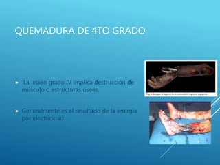 QUEMADURA DE 4TO GRADO
 La lesión grado IV implica destrucción de
músculo o estructuras óseas.
 Generalmente es el resultado de la energía
por electricidad.
 