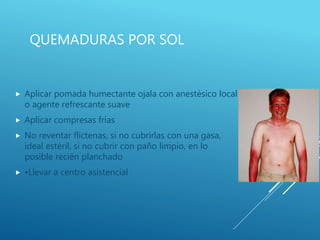 QUEMADURAS POR SOL
 Aplicar pomada humectante ojala con anestésico local
o agente refrescante suave
 Aplicar compresas frías
 No reventar flictenas, si no cubrirlas con una gasa,
ideal estéril, si no cubrir con paño limpio, en lo
posible recién planchado
 •Llevar a centro asistencial
 