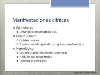 Manifestaciones clínicas 
 Pulmonares 
 Linfangioleiomiomatosis 1-6% 
 Genitourinario 
 Quistes renales 
 Tumores renales (pueden progresar a malignidad) 
 Neurológico 
 Lesiones cerebrales hamartomatosas 
 Nódulos subependimales 
 Tubérculos corticales 
http://omim.org/entry/191100 
 